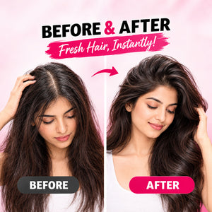 Jaquline USA Hair Zap Hair Dry Shampoo - 200 ml